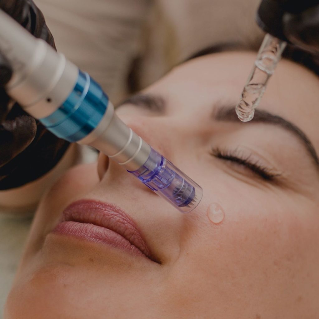 microneedling-aiguilles-serum-2