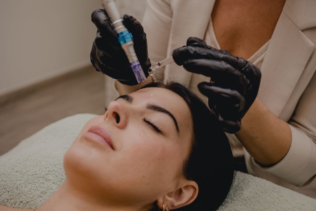Séance de soins esthétiques microneedling Nice